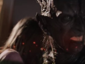 Patient Seven Picture